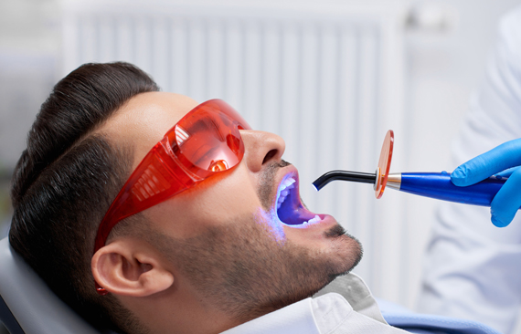 Why Might Dental Fillings Be Needed