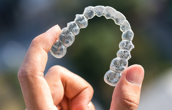 Why Would Invisalign Or Clear Aligners Be Needed