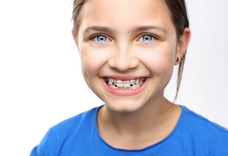 Orthodontics In Children, When Is It Necessary And What Should We Know