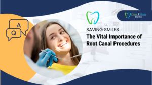 Root Canal Procedures