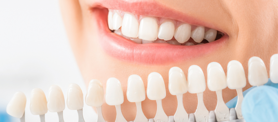 Dental Crowns The Teeth-Savers - Bedford, tx