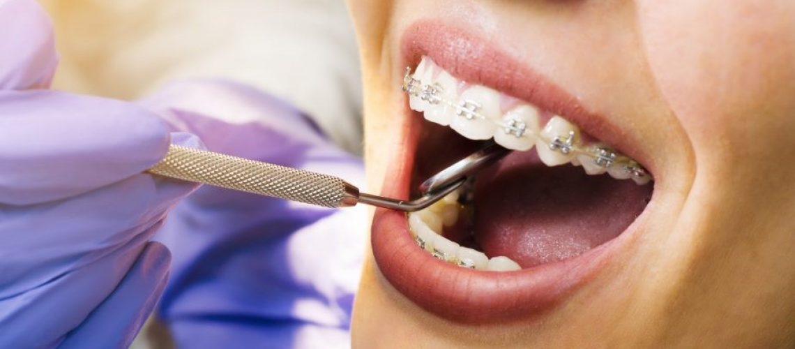 What Is The Difference Between A Dentist And An Orthodontist